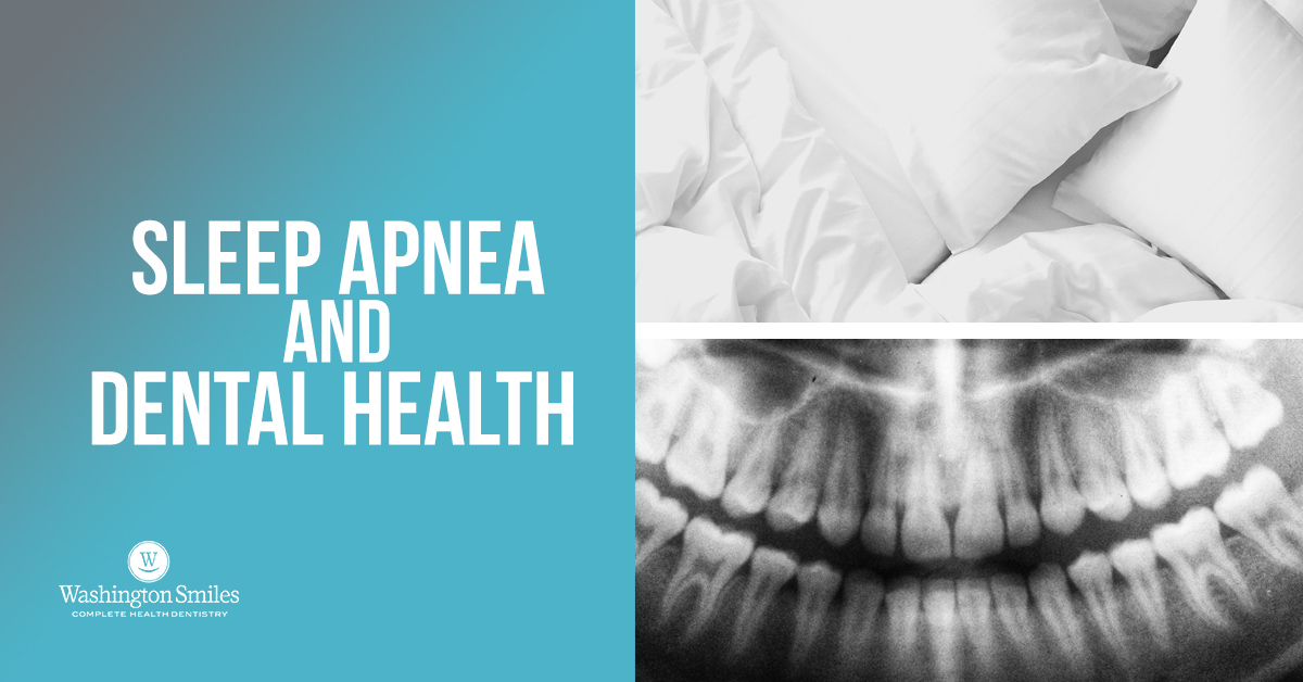 Sleep Apnea and Dental Health - Washington Smiles Complete Health Dentistry